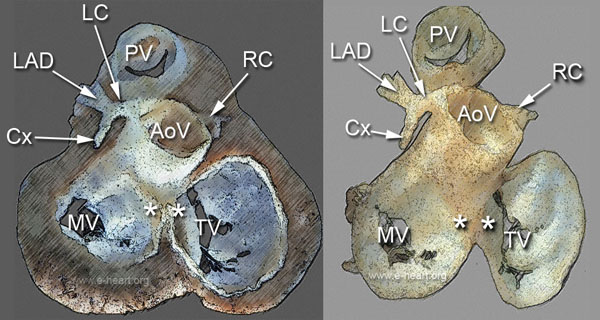 Fibrous Skeleton 01